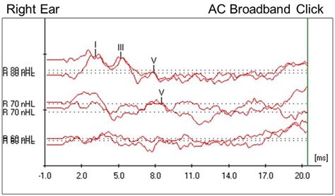 abr results|Iba pa.